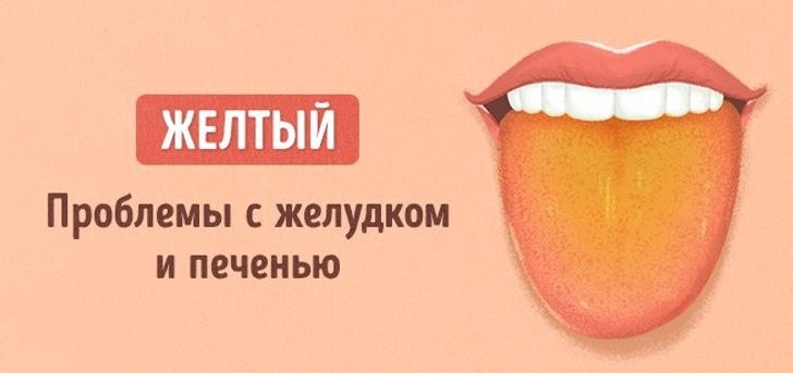 Цвет языка о чем говорит картинки