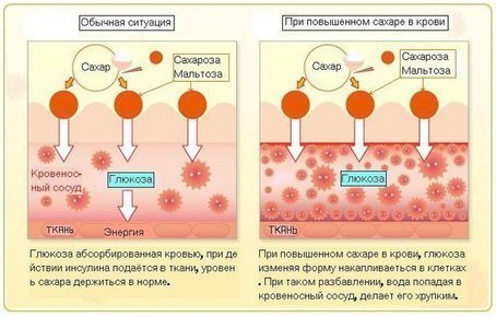 �������� ����������� ������ ������ �����.��� ����������� ���������� ������ ������ � ����� ����� ...