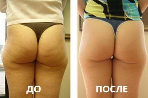 ˨     ! https://fotostrana.ru/away?to=/sl/XCL2 ,   ! ... - 6