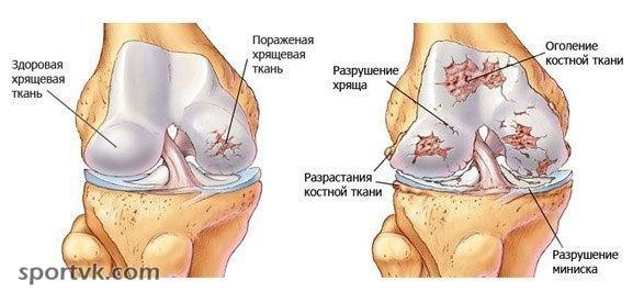 #SPORT_здоровье@sports_is_life.Почему хрустят суставы. Что мы должны об этом знать?Во время движения ...