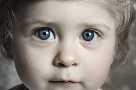 При каких заболеваниях у детей бывают синяки под глазами