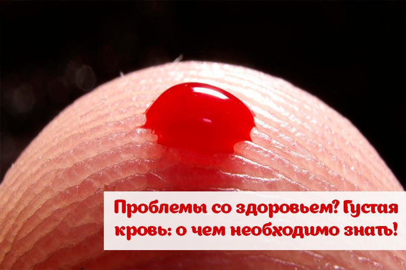 Проблемы со здоровьем? Густая кровь: о чем необходимо знать! Густая кровь — это повышение вязкости ...