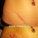 ���� Liana, �����������, 45 ��� - ��������� 14 ��� 2016 � ������ ����� (�������� � 2006 ����.)�