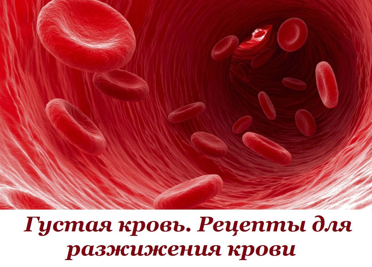 Академия здоровой жизни написал 5 мая 2016 в 23:13: &quot;<b>ГУСТАЯ</b> <b>КРОВЬ</b>....