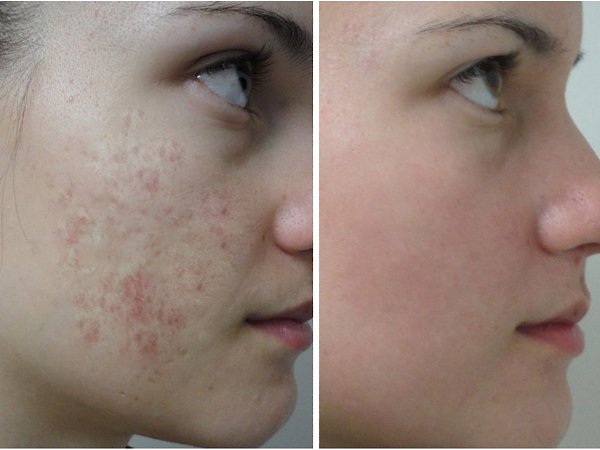 ��� ��� ����� ��������, ������ �� �� ��������. Ÿ �������� � ��� 14 ������� ��������, ����� ������ ...