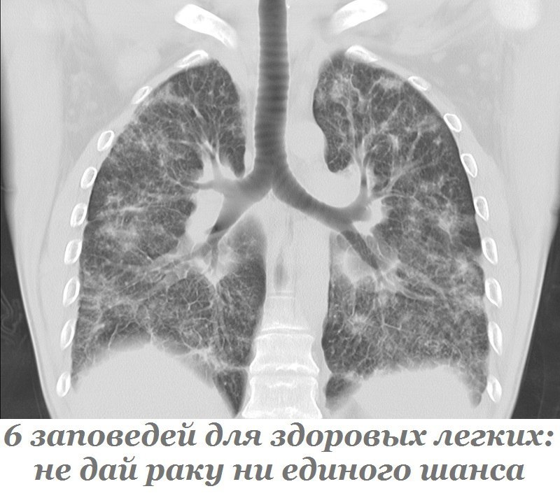 6 заповедей для здоровых легких: не дай раку ни единого шанса. Без кислорода существование человека ...