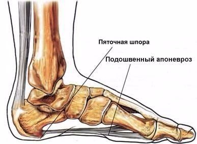 Лечение пяточной шпоры с помощью народных средств. Народный рецепт №1: лечение картофелем Возьмите ...