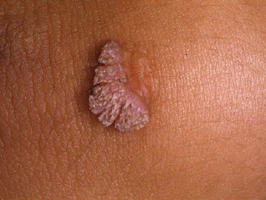 �� ��������� �� ����. ��� ����� ��������� � ��� ��� ������ ������ ����� ...