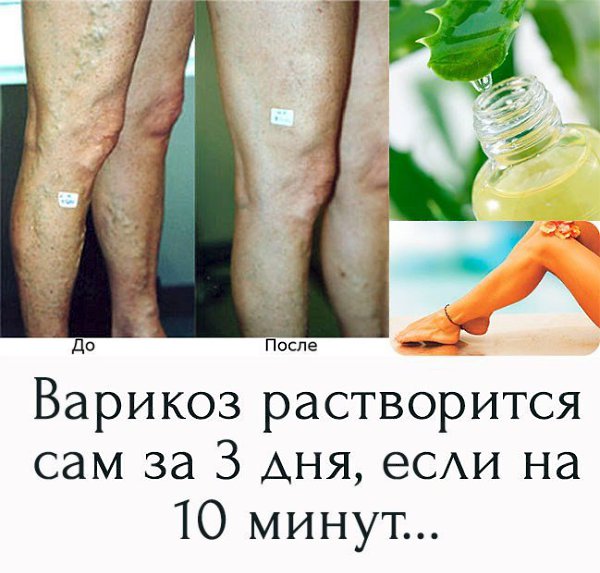   !!!     .. http://problogpro.ru/rd/GmzB5