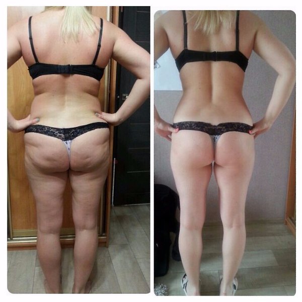 КАК СБРОСИТЬ 20 КГ ЖИPA ЗА МЕСЯЦ ДО НОВОГО ГОДА? Да, знаю, тема может быть для тебя больной. Но я ...