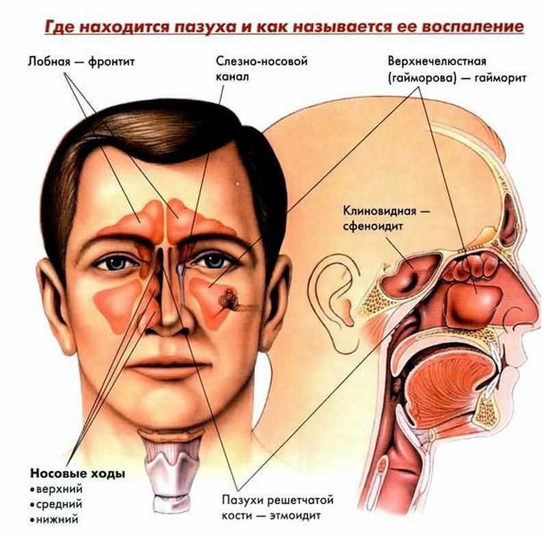 ЗАЛОЖИЛО НОС? ВЫБИРАЙТЕ РЕЦЕПТ! 1-й рецепт (противопростудный отвар): необходимо взять горсть плодов ...