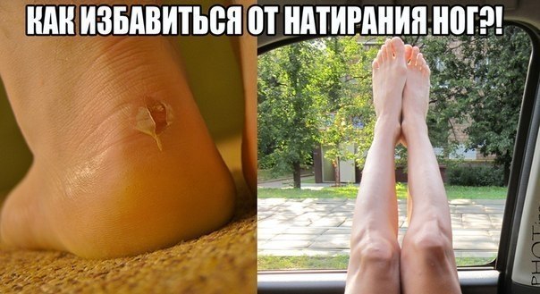 Как избавиться от натирания ног? Часто бывает, что ты покупаешь себе замечательные туфли, о которых ...
