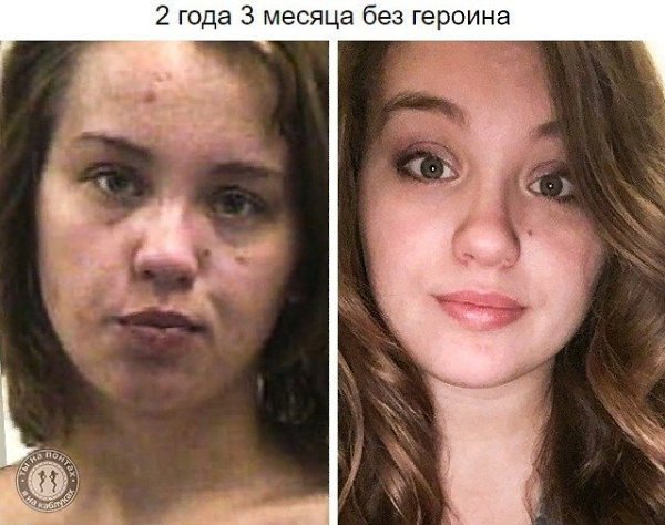 Как выглядят люди, которые смогли отказаться от наркотиков: - 4