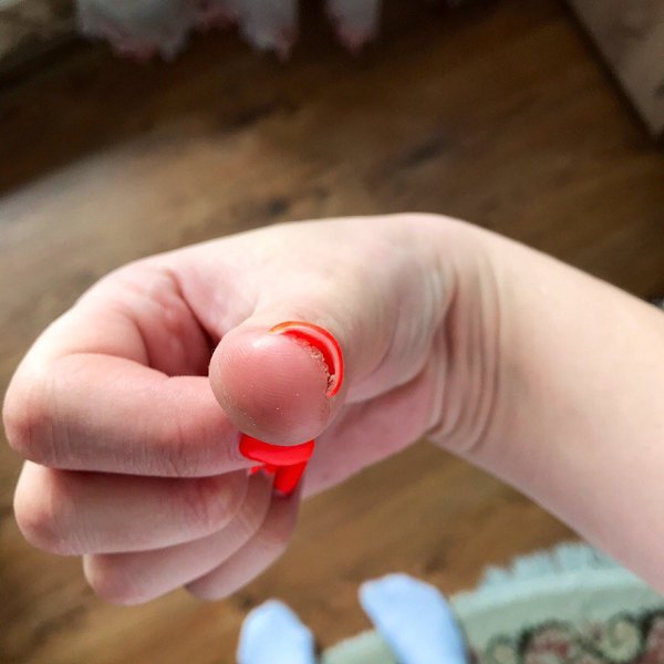 #Истории@modnailru. Девочки!!!Помогите Мастер переусердствовала с аппаратом и после того как под ...