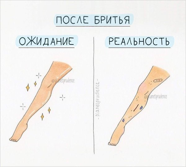 e p    e - 4