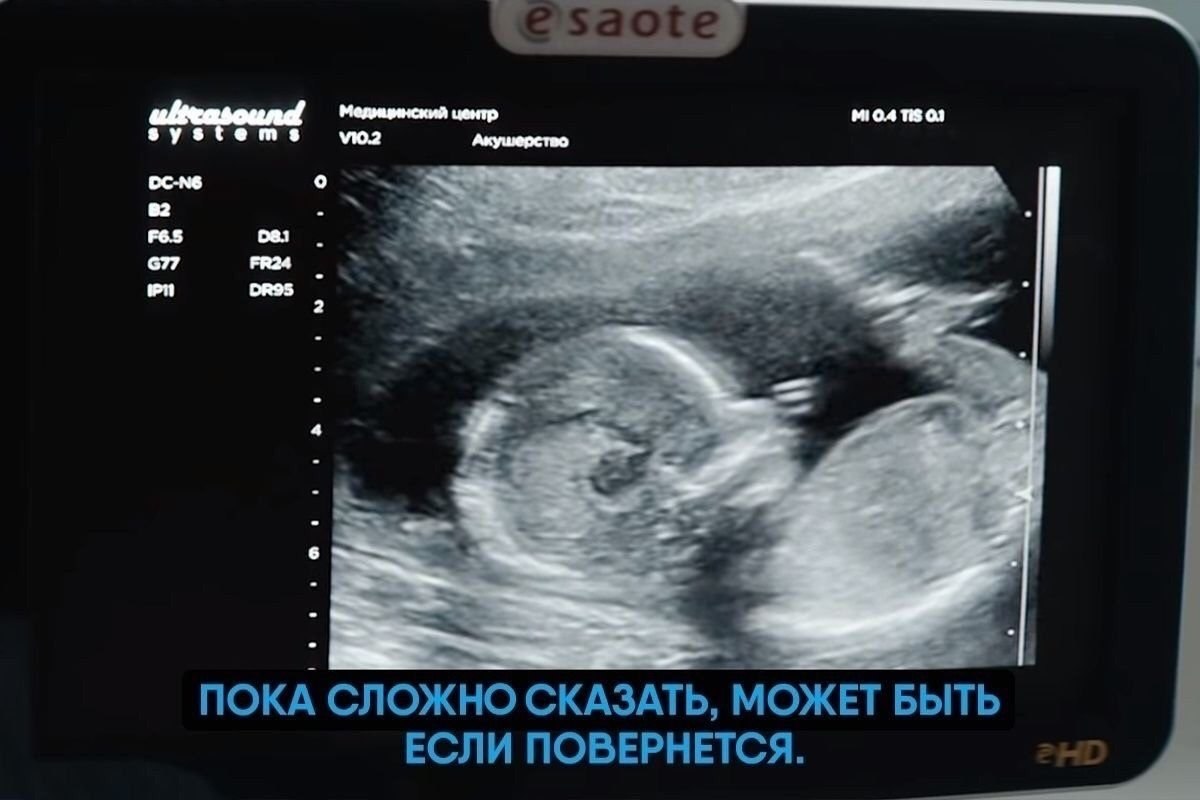    ,   !) - 2