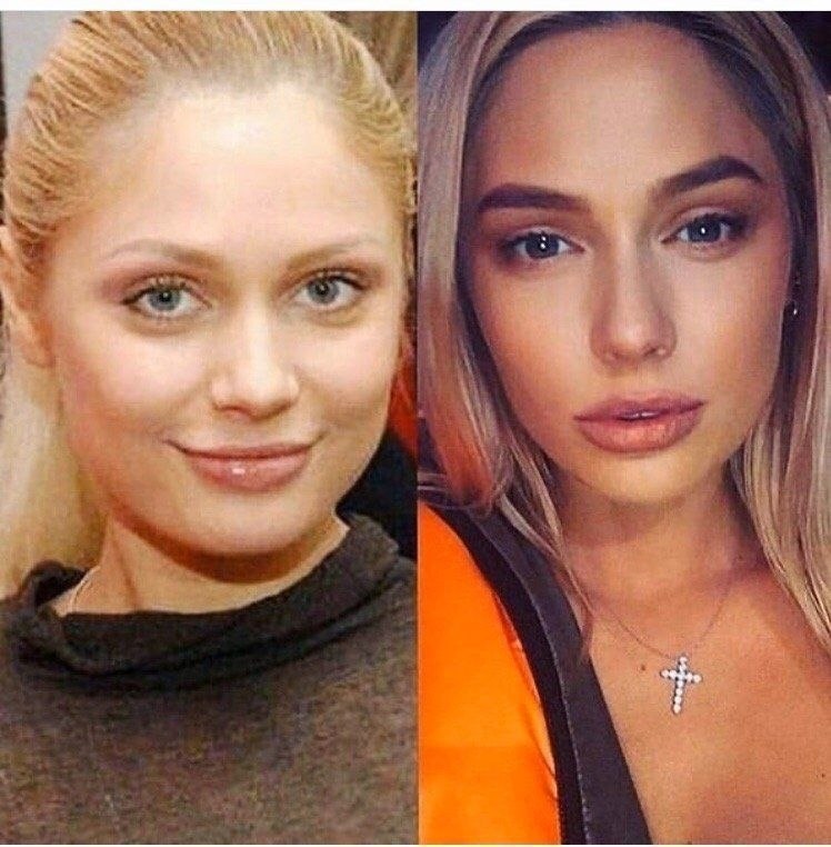 Лунаком до пластики. Турецкая актриса рабиа. Джанер сойтюрк. Эким до пластики. Рабиа сойтюрк актриса.