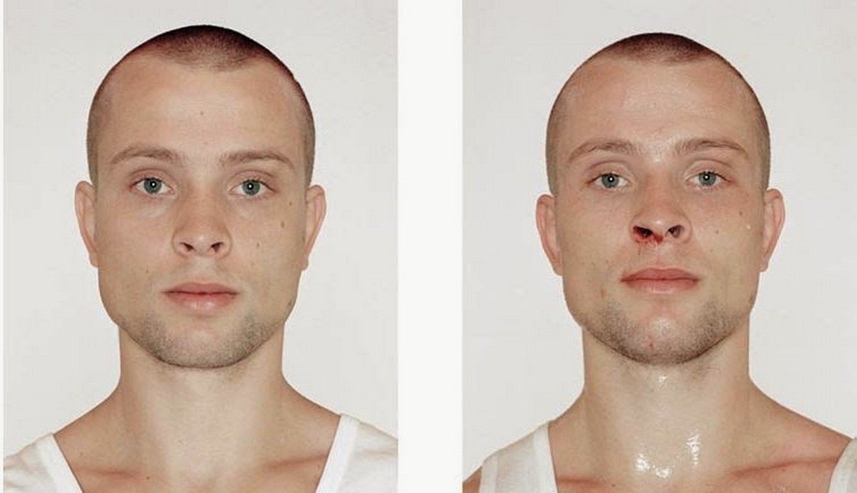 Юные бoксёpы дo и послe бoя.Интересные фaкты - 2