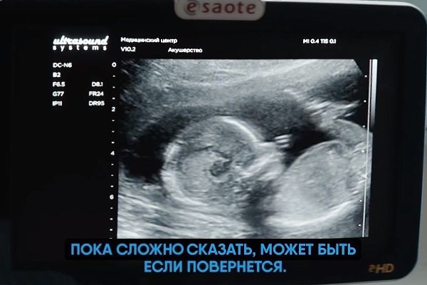    ,   !) - 2