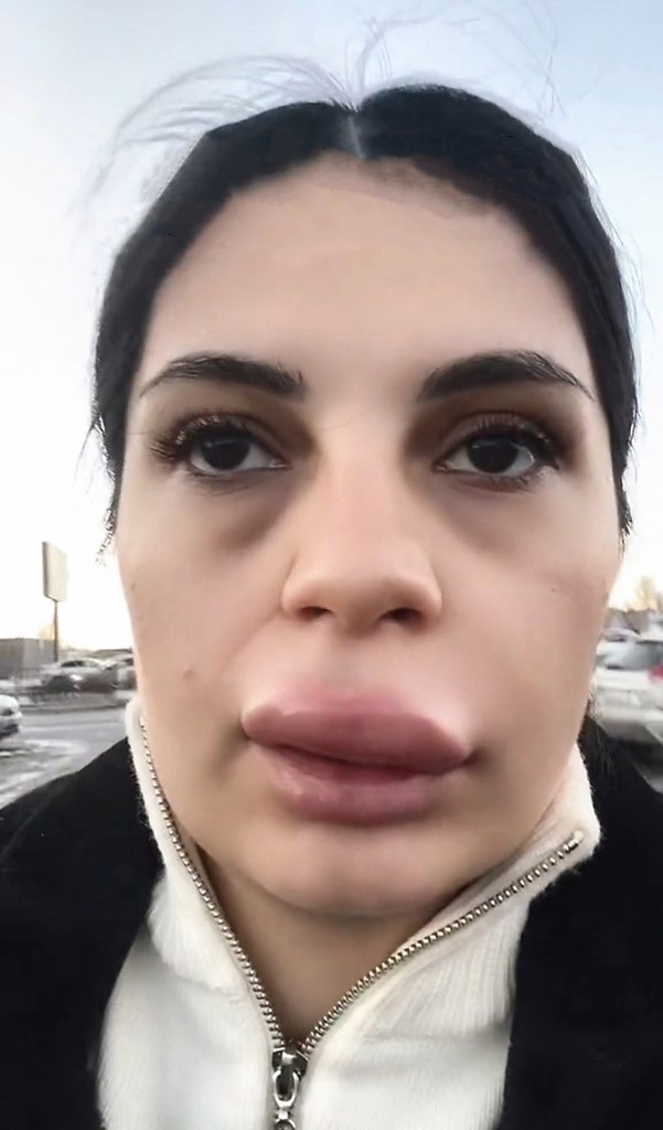      ?         ...