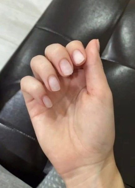    : - 2