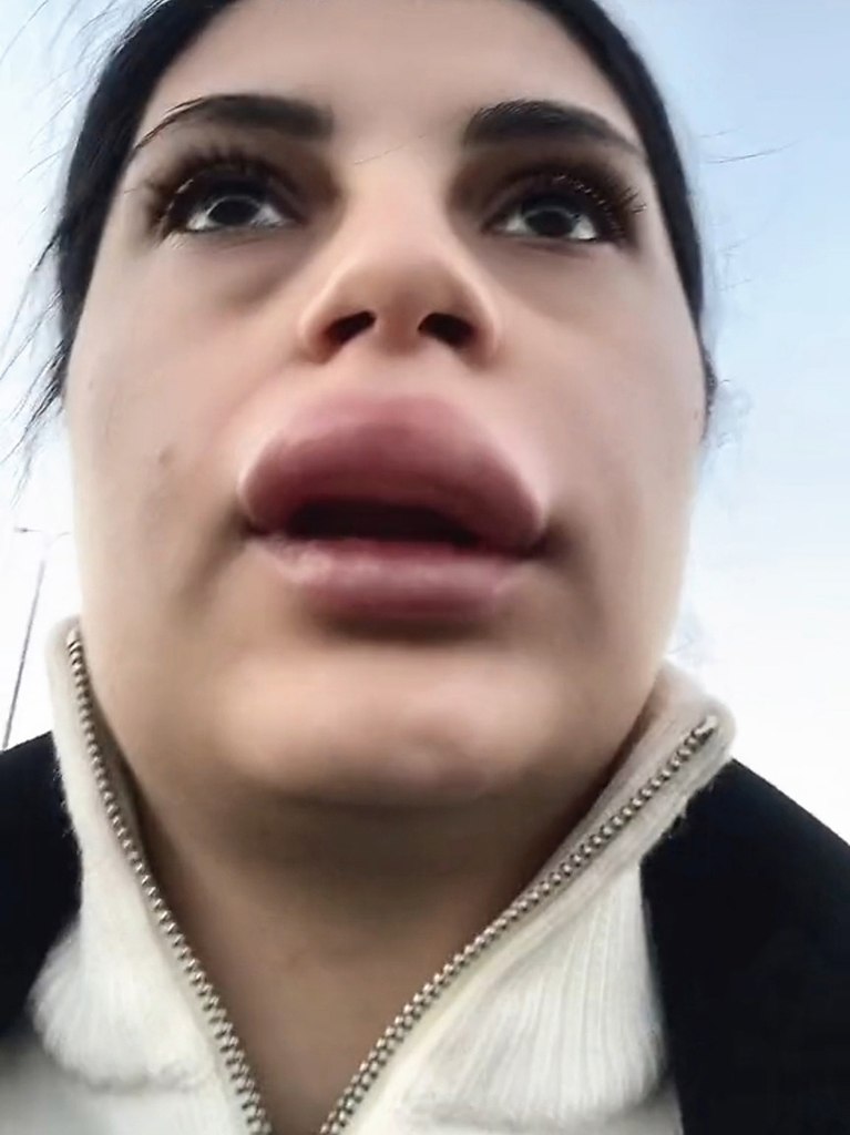      ?         ... - 2