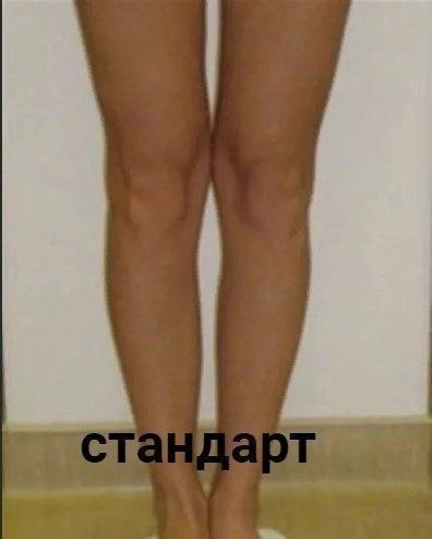  ,  ... - 2
