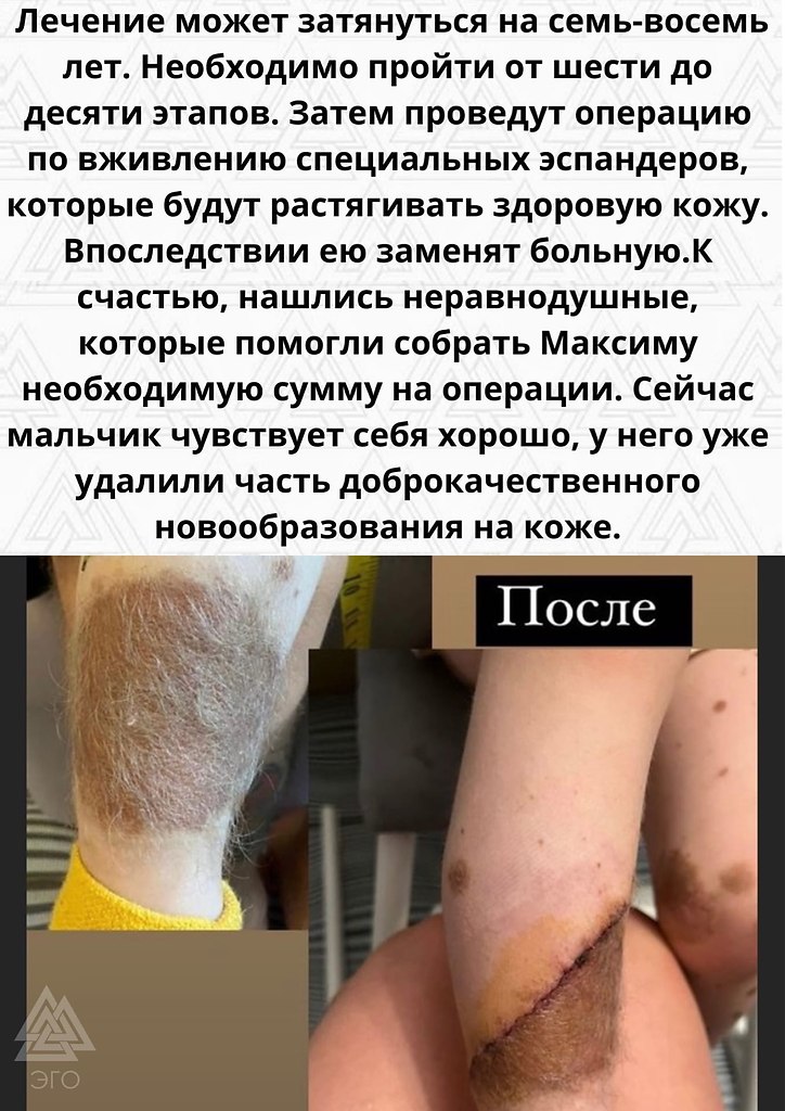    - 3