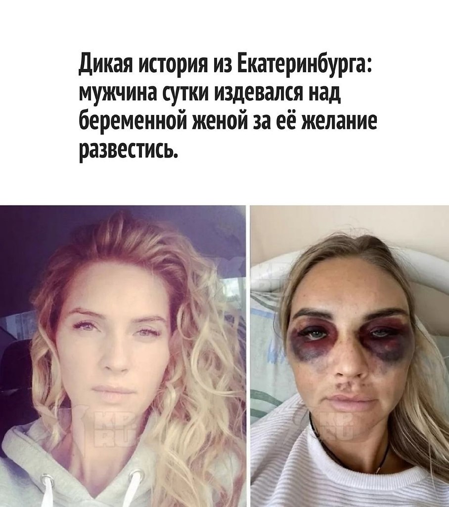  ,  .