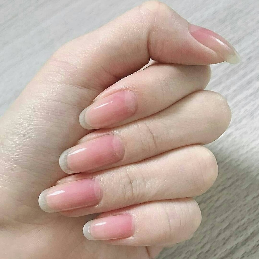      ? - 3