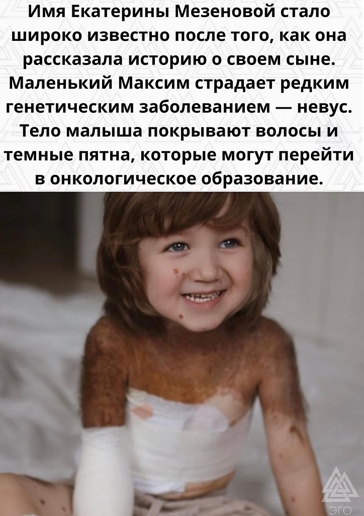    - 2