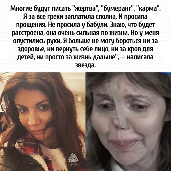 У девушки обнаружили аутоиммунный некроз. Заболевание провоцирует разрушение кровеносных сосудов и ... - 2