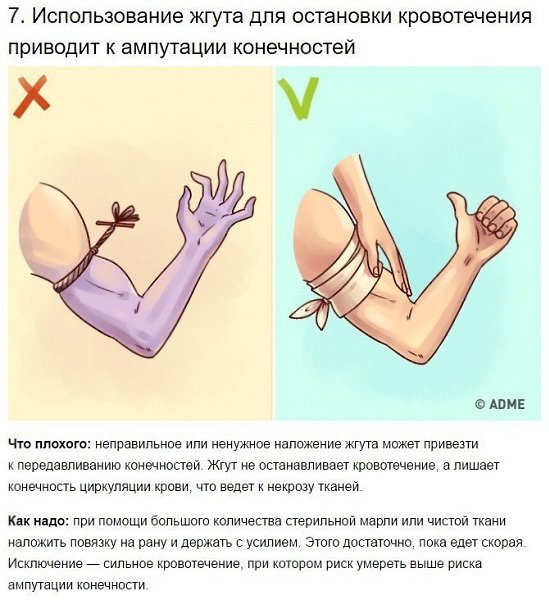 9 известных приемов первой помощи, которые 90% людей делают неправильно. - 7