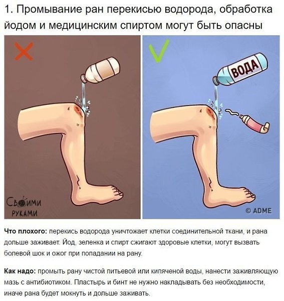 9 известных приемов первой помощи, которые 90% людей делают неправильно. - 3