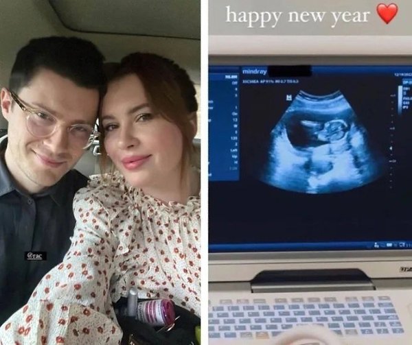 27-летняя дочь Алека Болдуина и Ким Бейсингер объявила о беременности. 64-летний американский актер ... - 2