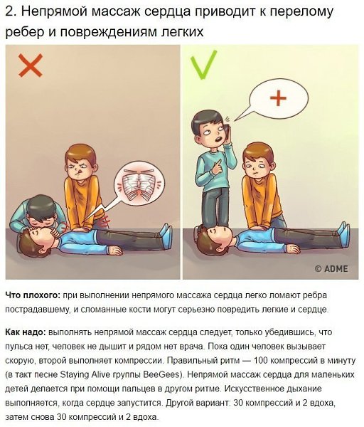 9 известных приемов первой помощи, которые 90% людей делают неправильно. - 4