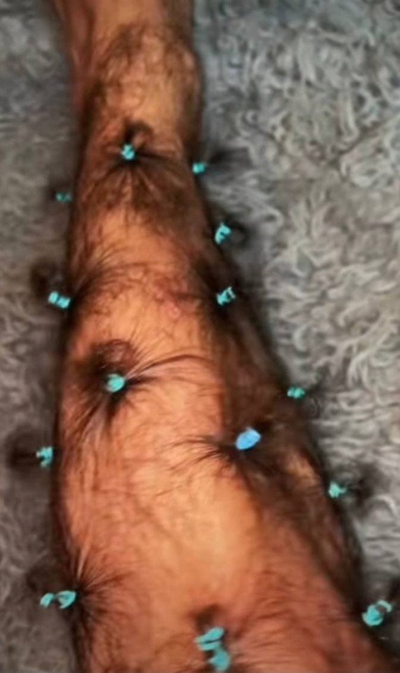     - 2