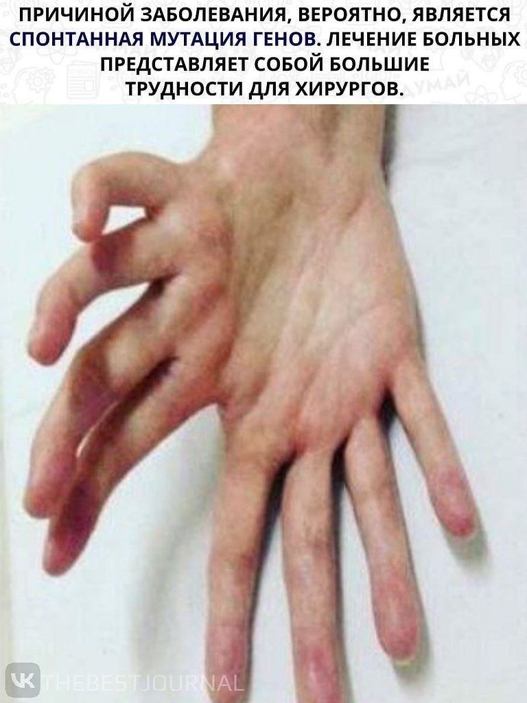         ,        - 2
