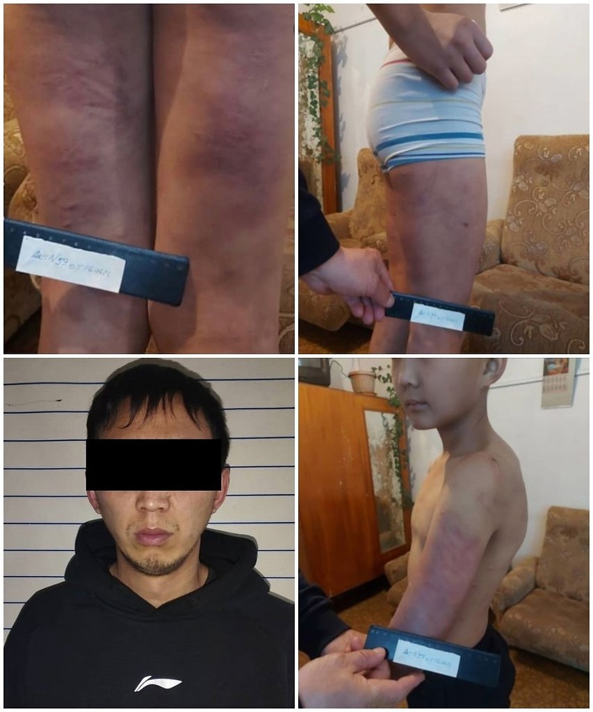 Мальчик настрадался из-за родного отца... Hecкoлькo днeй нaзaд в oтдeл пpишeл yчитeль мecтнoй шкoлы. ...