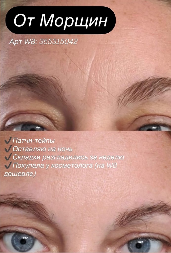   WB: https://fotostrana.ru/away?to=/sl/Gur5