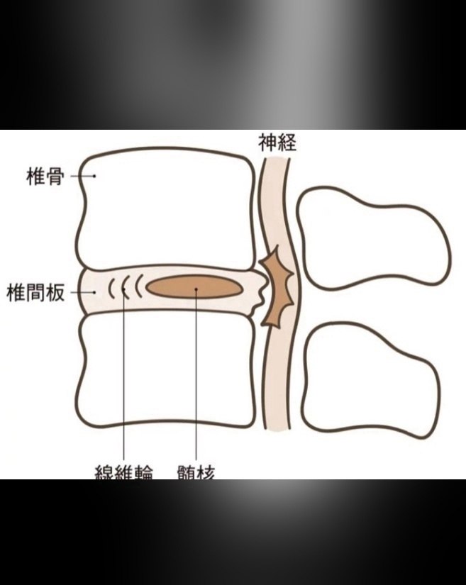 В одну из японских клиник поступил мужчина с необычной проблемой. В его прямой кишке застрял большой ... - 2