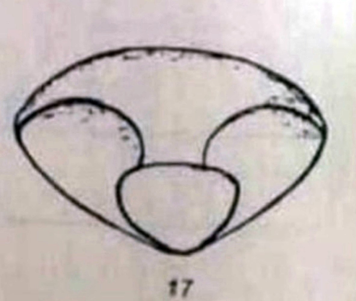     - 2