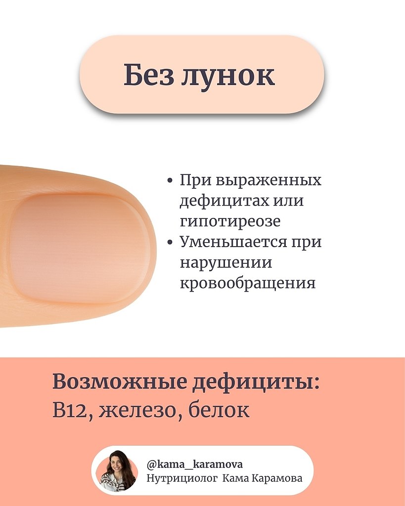  - 25  2025  17:42 - 3