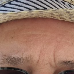 �����, �����-���������, 75 ���