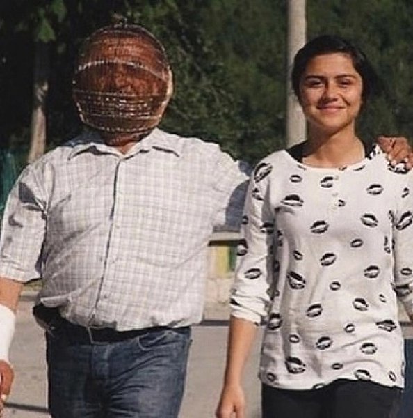 Жестко, но мужчина, житель Турции, решил бpoсить курить и для этого пpидумал оригинальный способ: он ... - 2