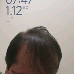 ���� ������, �������, 46 ��� - ��������� 14 ������ 2025