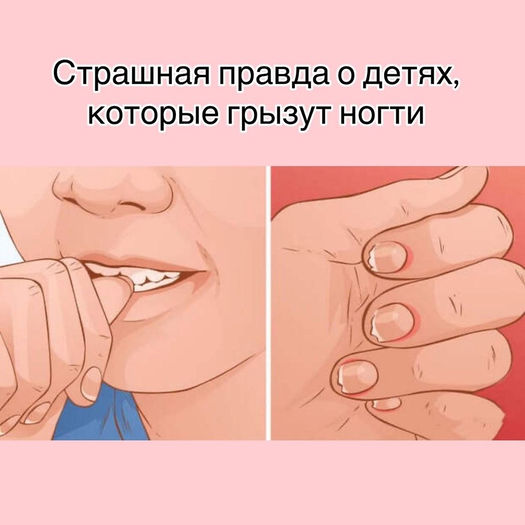 Страшная правда о детях, которые грызут ногти.Дети грызут ногти не от вредной привычки. За этим ...