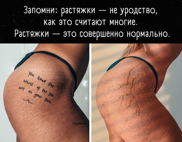 Растяжки это не проблема! Проблема это не уметь любить себя!