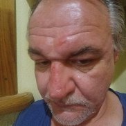 ��������, 55 ���, �����������