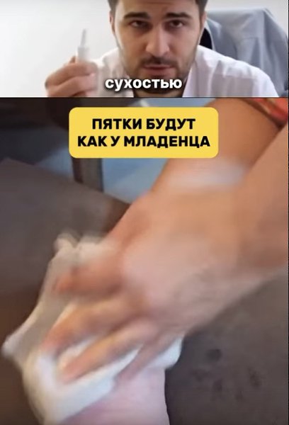 Рецепт для нежной кожи пяток, приготовленный из натуральных ингредиентов. - 2